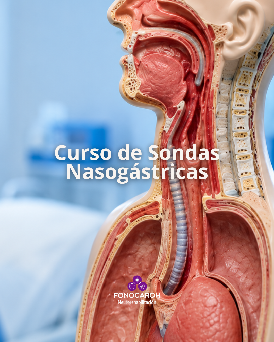Curso de Sondas Nasogastricas: Tecnica Segura y Manejo Especializado